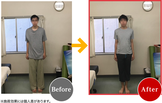 Before After